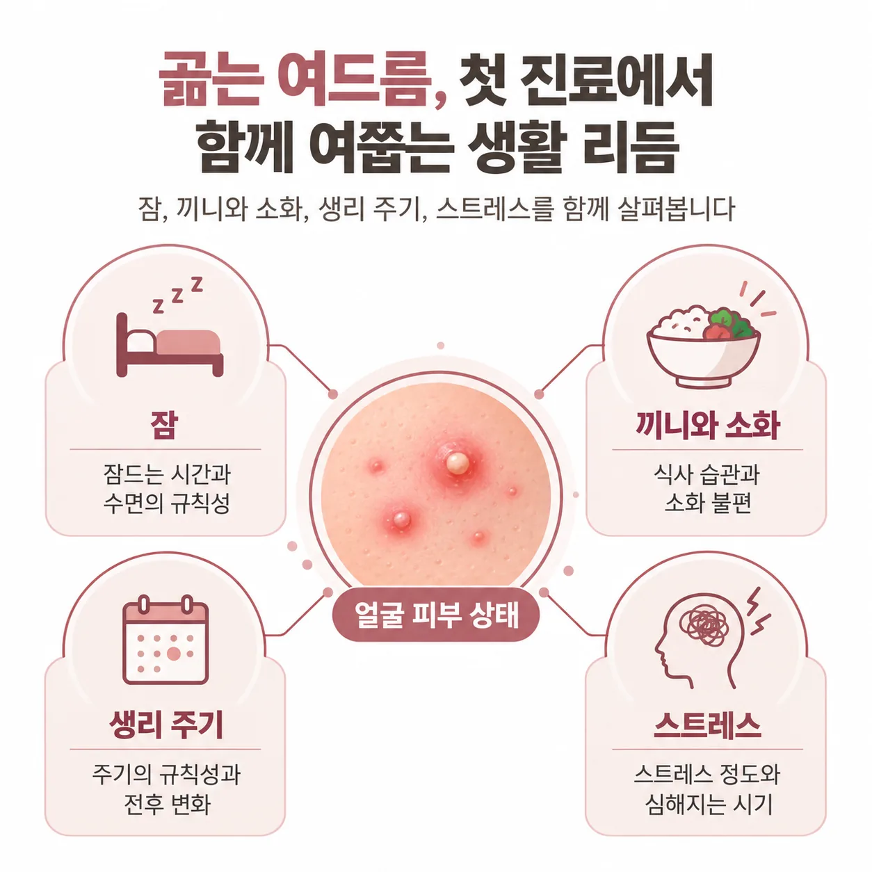 곪는 여드름 첫 진료에서 함께 여쭙는 잠과 소화, 생리 주기, 스트레스 개념도