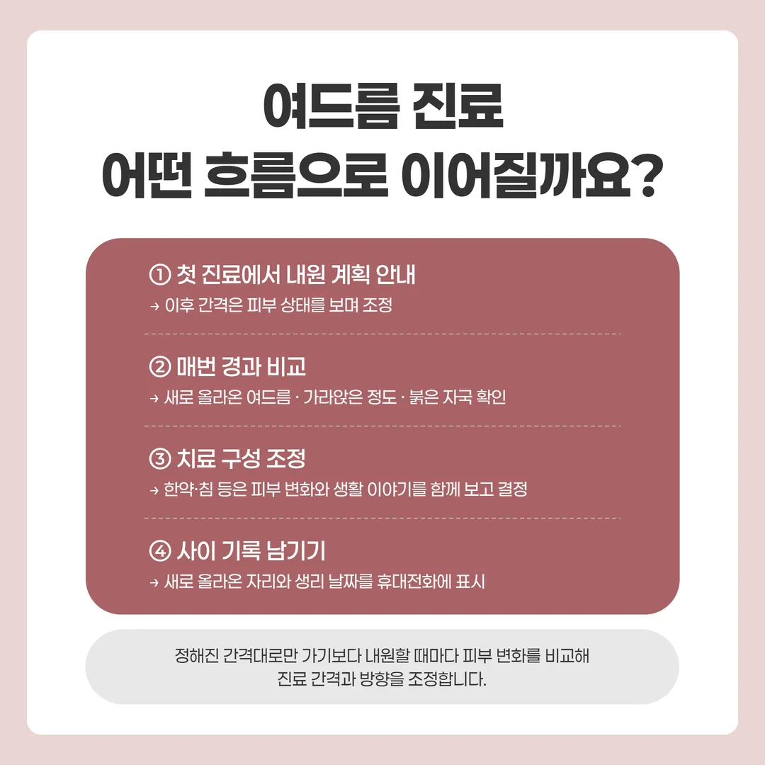 곪는 여드름 진료가 첫 진료와 내원 때마다의 경과 비교, 내원 간격 조정으로 이어지는 흐름도