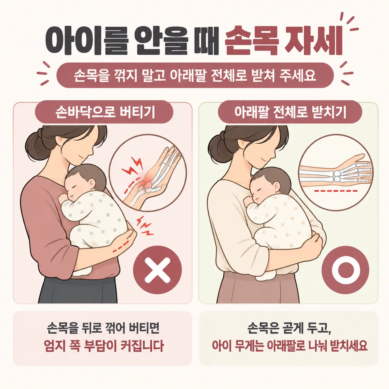 아이를 안을 때 손목을 꺾는 자세와 아래팔 전체로 받치는 자세의 손목 각도 비교 선화